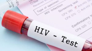 HIV Testing London
