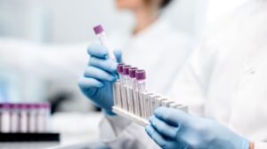 blood tests taken for syphilis testing