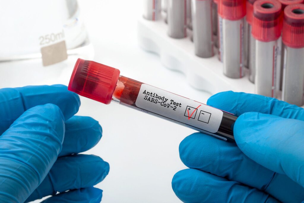 Everything You Need to Know About Omicron | Broadgate GP Novel coronavirus clinical antibody testing and Covid-19 diagnostic concept with doctor holding blood plasma sample used to test for SARS-CoV-2 antigen with a red check in the positive box