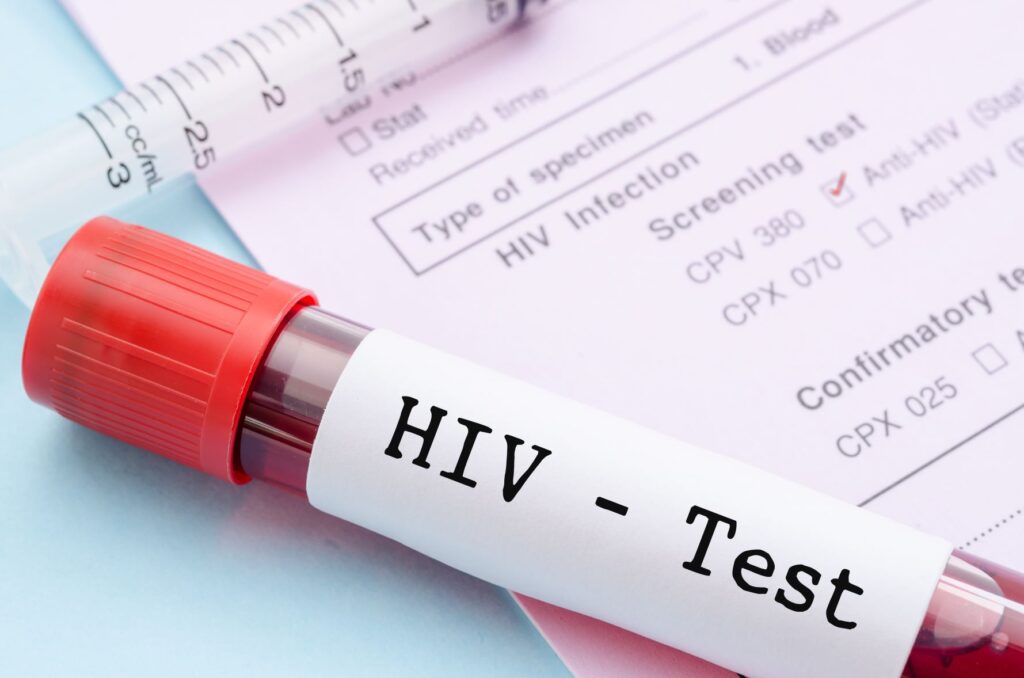 HIV Testing