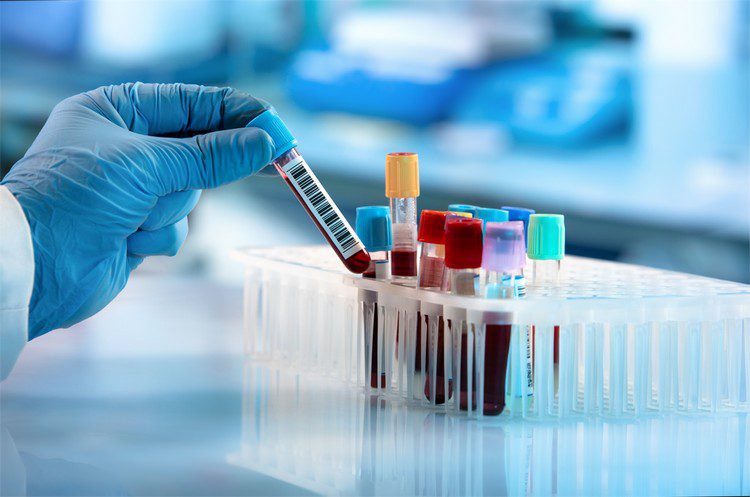 Preparing for a Blood Test? What you Need to Know! | Broadgate GP Preparing for a Blood Test? What you Need to Know! | Broadgate GP