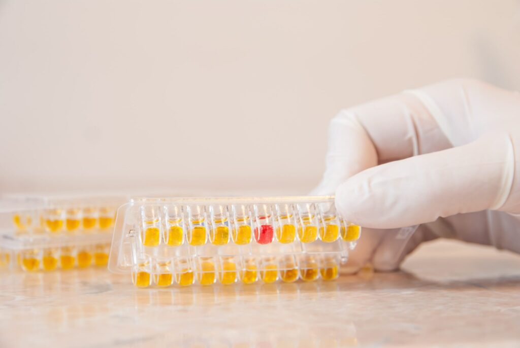 testing for ureaplasma