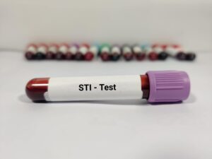 sti test vial