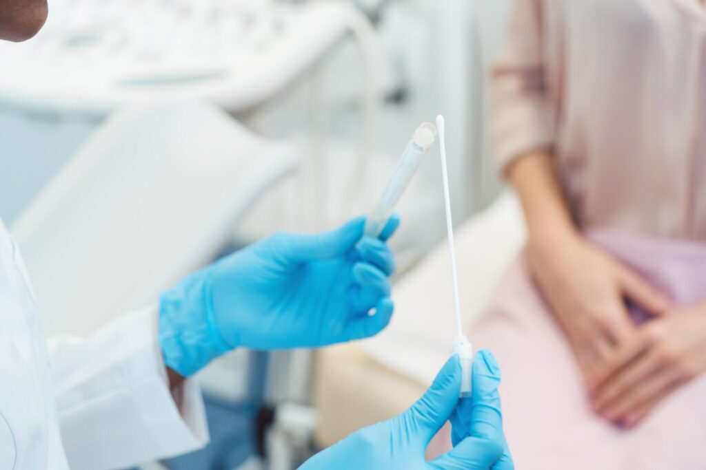 STI Testing: How Long to Wait? | Broadgate GP sti swab being collected
