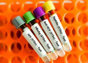 STI Testing: How Long to Wait?