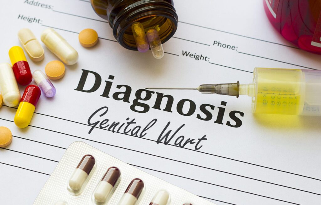 genital warts