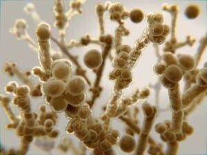 What Causes Thrush?