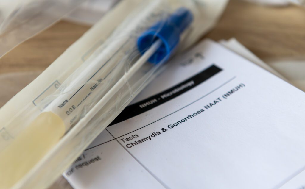 Record STI Diagnoses in England