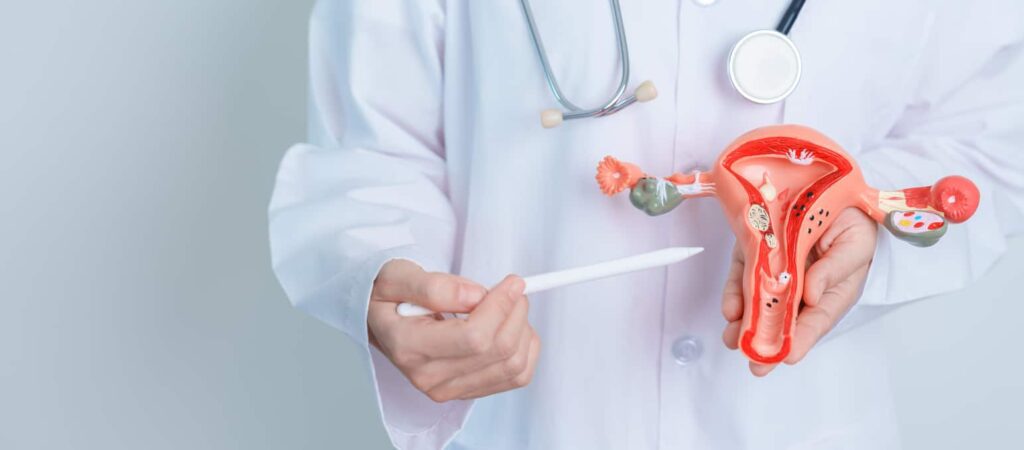 Doctor holding Uterus and Ovaries model. Ovarian and Cervical cancer, Cervix disorder, Endometriosis, Hysterectomy, Uterine fibroids, Reproductive system and Pregnancy concept
