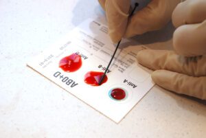 blood group test - Blutgruppentest