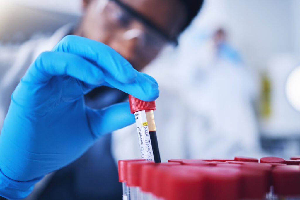 Science, blood and hands with test tube in laboratory for research, medical exam and sample analysis. Healthcare, pharmaceutical and black man scientist with vial for dna experiment, rna and genetics