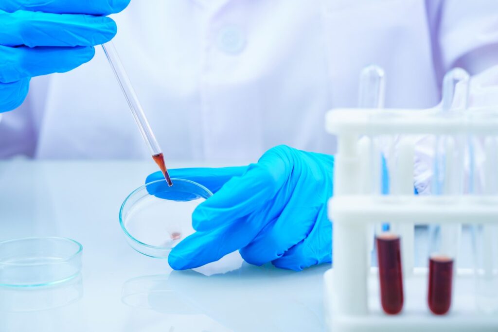 Scientist analyzing a blood sample on tray in laboratory