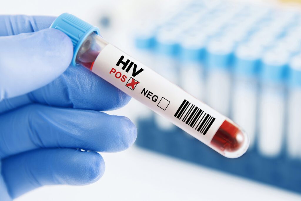 test tube containing HIV positive blood