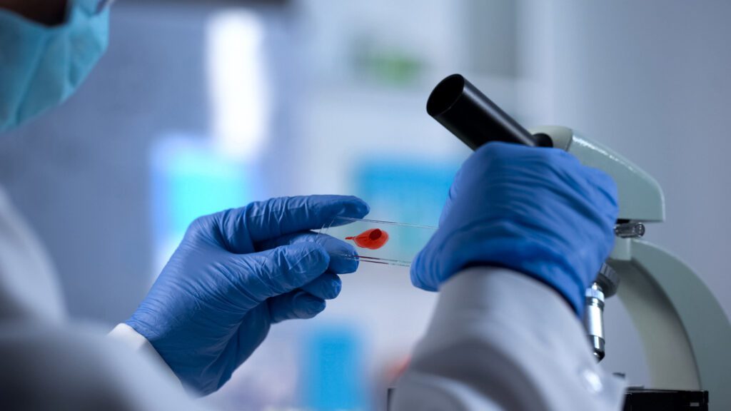 AIDS checkup, researcher preparing to examine blood sample under microscope