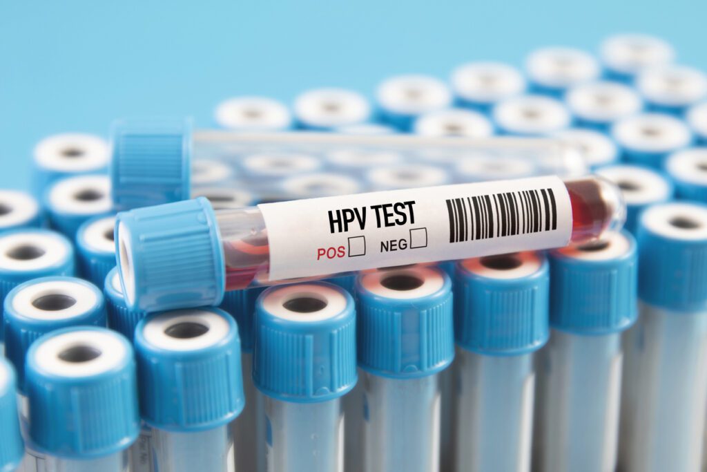 HPV Test