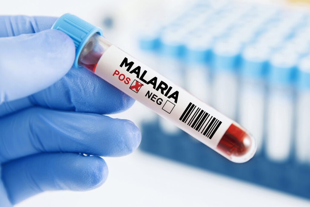 blood that is positive for malaria