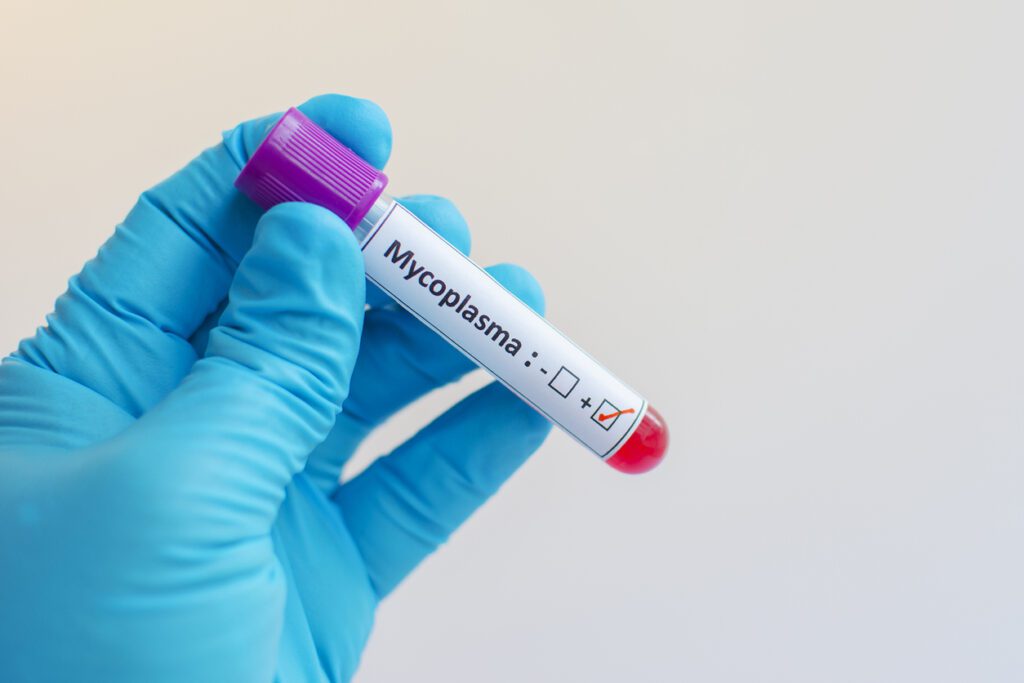 Mycoplasma blood sample