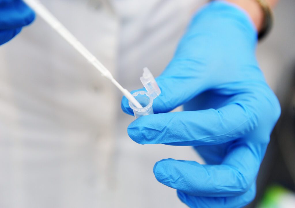 A gynecologist in blue gloves is taking an analysis for research. Gynecologist taking a smear.